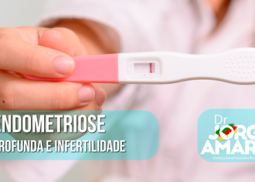 Endometriose Profunda e Infertilidade